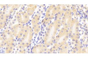 Detection of MMP10 in Mouse Kidney Tissue using Polyclonal Antibody to Matrix Metalloproteinase 10 (MMP10)