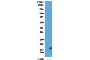Western blot of acid extracts from HeLa cells untreated (-) or treated (+) with sodium butyrate using recombinant H3K27ac antibody at 1 ug/ml showed a band of Histone H3 acetylated at Lysine 27 in treated HeLa cells. (Recombinant Histone 3 antibody  (acLys27))