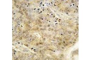 Immunohistochemistry (IHC) image for anti-Enhancer of Zeste Homolog 1 (EZH1) (AA 393-422) antibody (ABIN3030806)