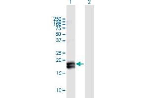 Western Blot analysis of IFNA2 expression in transfected 293T cell line by IFNA2 MaxPab polyclonal antibody. (IFNA2 antibody  (AA 1-188))