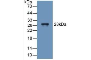 Detection of Recombinant TUBd, Mouse using Polyclonal Antibody to Tubulin Delta (TUBd) (TUBD1 antibody  (AA 236-455))