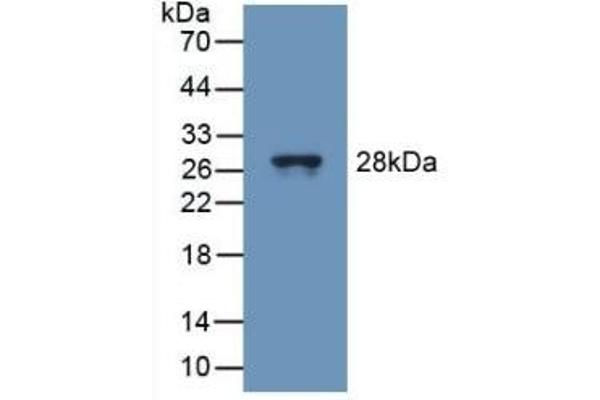 TUBD1 Antikörper  (AA 236-455)