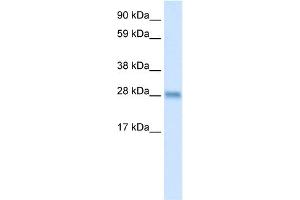 WB Suggested Anti-BCL2L1 Antibody Titration:  0. (BCL2L1 antibody  (N-Term))