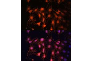 Immunofluorescence analysis of C6 cells using E2F1 Polyclonal Antibody (ABIN3022839, ABIN3022840, ABIN3022841, ABIN1512843 and ABIN6219253) at dilution of 1:100 (40x lens). (E2F1 antibody)