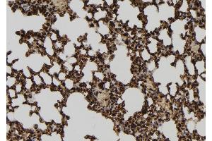 ABIN6279434 at 1/100 staining Mouse lung tissue by IHC-P. (GPATCH8 antibody  (Internal Region))