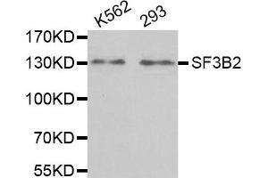 Western Blotting (WB) image for anti-Splicing Factor 3b, Subunit 2, 145kDa (SF3B2) antibody (ABIN1980242) (SF3B2 antibody)