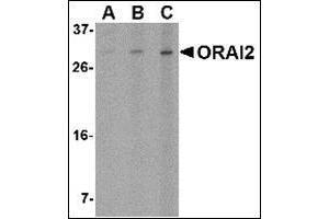 Western blot analysis of ORAI2 in Jurkat cell lysate with this product at (A) 1, (B) 2 and (C) 4 μg/ml. (ORAI2 antibody  (C-Term))