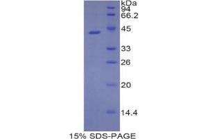SDS-PAGE analysis of Rat Lipocalin 9 Protein. (LCN9 Protein)