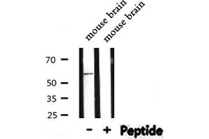 Western blot analysis of INA expression in Mouse brain lysate (INA antibody  (Internal Region))