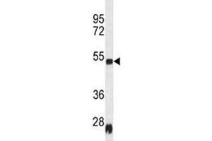 Western blot analysis of Serpinh1 antibody and rat heart tissue lysate (SERPINH1 antibody  (AA 222-251))