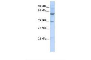 SLC35F3 抗体  (AA 216-265)