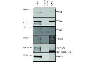 Immunoprecipitation analysis using Mouse Anti-VPS35 Monoclonal Antibody, Clone 10A8 (ABIN6932998).