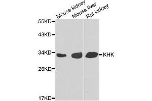 Western blot analysis of extracts of various cell lines, using KHK antibody. (Ketohexokinase antibody  (AA 1-298))