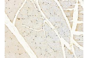 ABIN6259212 and ABIN6273405 at 1/100 staining rat muscle tissue by IHC-P.