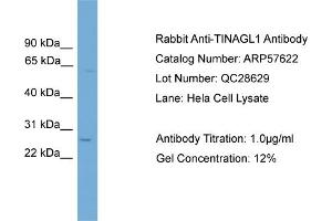 WB Suggested Anti-TINAGL1  Antibody Titration: 0. (TINAGL1 antibody  (Middle Region))