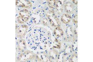 Immunohistochemistry of paraffin-embedded rat kidney using NEDD4L antibody.