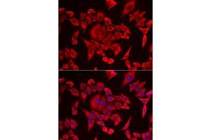 Immunofluorescence analysis of HeLa cell using SLC20A2 antibody. (SLC20A2 antibody)