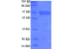 SDS-PAGE (SDS) image for Actin, alpha 1, Skeletal Muscle (ACTA1) (AA 3-377) protein (His tag) (ABIN5708995) (Actin Protein (AA 3-377) (His tag))