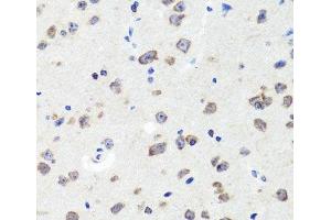Immunohistochemistry of paraffin-embedded Mouse brain using DLG1 Polyclonal Antibody at dilution of 1:100 (40x lens).