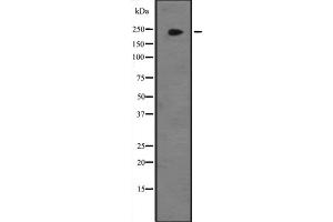 Western blot analysis of JMJD1B expression in Hela cell lysate,The lane on the left is treated with the antigen-specific peptide. (KDM3B antibody  (Internal Region))