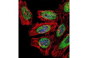 Fluorescent confocal image of Hela cell stained with SP140 Antibody .