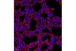Immunofluorescence of paraffin embedded rat lung using MYL6 (ABIN7074734) at dilution of 1:650 (400x lens) (MYL6 antibody)