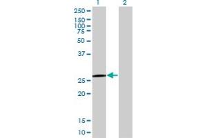 Western Blot analysis of QDPR expression in transfected 293T cell line by QDPR monoclonal antibody (M02), clone M1. (QDPR antibody  (AA 1-244))