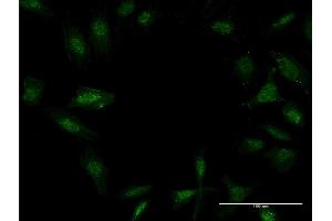 Immunofluorescence of monoclonal antibody to TWIST2 on HeLa cell.