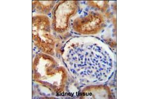 SLC5A12 antibody immunohistochemistry analysis in formalin fixed and paraffin embedded human kidney tissue followed by peroxidase conjugation of the secondary antibody and DAB staining. (SLC5A12 antibody  (C-Term))