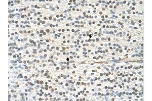 Immunohistochemistry (IHC) image for anti-GTPase Activating Protein and VPS9 Domains 1 (GAPVD1) (N-Term) antibody (ABIN2775423) (GAPVD1 antibody  (N-Term))