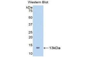 Western Blotting (WB) image for anti-S100 Calcium Binding Protein A8 (S100A8) (AA 1-93) antibody (ABIN3201624) (S100A8 antibody  (AA 1-93))