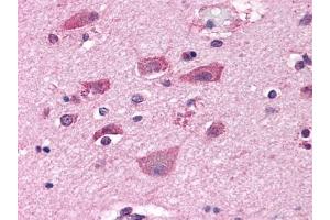 Immunohistochemical staining of Brain (Neurons and Glia) using anti- GRM7 antibody ABIN122320 (GRM7 antibody  (N-Term))