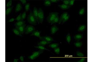 Immunofluorescence of monoclonal antibody to SET7 on HeLa cell. (SETD7 antibody  (AA 257-366))