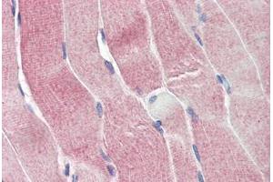 Human Skeletal Muscle (formalin-fixed, paraffin-embedded) stained with SIRT4 antibody ABIN337219 at 2. (SIRT4 antibody  (AA 302-314))