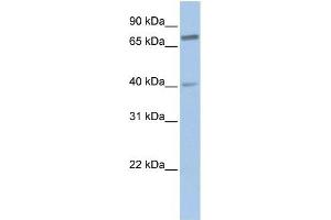 SSX2IP antibody used at 1 ug/ml to detect target protein. (SSX2IP antibody  (Middle Region))