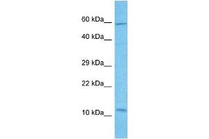 Host:  Rabbit  Target Name:  SLIRP  Sample Tissue:  Human HCT15 Whole Cell  Antibody Dilution:  1ug/ml (SLIRP antibody  (N-Term))