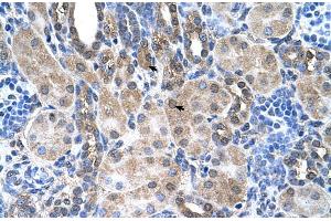 Human kidney (SLC6A18 antibody  (Middle Region))