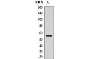 Western blot analysis of Beta-tubulin-HRP labled expression in Hela (A) whole cell lysates. (TUBB antibody  (HRP))
