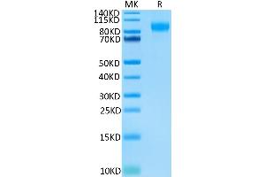 SDS-PAGE (SDS) image for Selectin E (SELE) (AA 22-556) protein (His-Avi Tag,Biotin) (ABIN7274573)