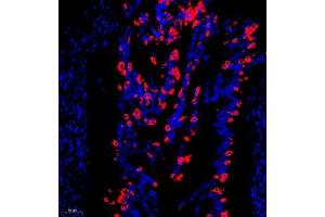 Immunofluorescence of paraffin embedded human uterus using AGR3 (ABIN7073074) at dilution of 1:800 (300x lens) (AGR3 antibody)