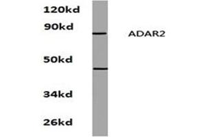 Image no. 1 for anti-Adenosine Deaminase, RNA-Specific, B1 (ADARB1) antibody (ABIN272206) (RED1 antibody)