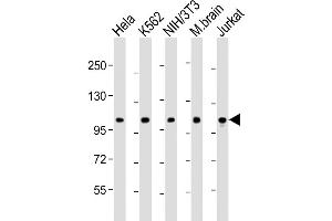 Western Blot at 1:2000 dilution Lane 1: Hela whole cell lysate Lane 2: K562 whole cell lysate Lane 3: NIH/3T3 whole cell lysate Lane 4: mouse brain lysate Lane 5: Jurkat whole cell lysate Lysates/proteins at 20 ug per lane.