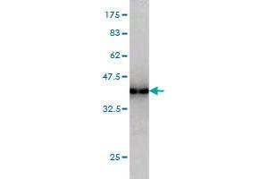 Western Blot detection against Immunogen (36. (SNF8 antibody  (AA 23-122))