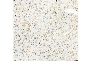 IHC analysis of MID1 using anti-MID1 antibody (ABIN6719400). (MID1 antibody  (AA 226-278))