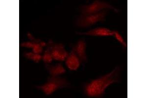 ABIN6269402 staining COS7 by IF/ICC. (DARPP32 antibody)