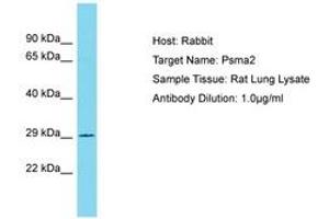 Image no. 1 for anti-Proteasome Subunit alpha 2 (PSMA2) (AA 122-171) antibody (ABIN6750359) (PSMA2 antibody  (AA 122-171))