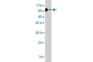 Western Blot detection against Immunogen (95.