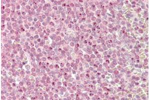 Image no. 1 for anti-Myeloid/lymphoid Or Mixed-Lineage Leukemia 2 (MLL2) (AA 2-14) antibody (ABIN1494780) (MLL2 antibody  (AA 2-14))