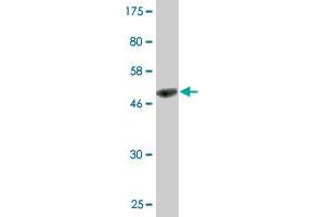 Western Blot detection against Immunogen (50. (IPP Isomerase 2 antibody  (AA 1-227))