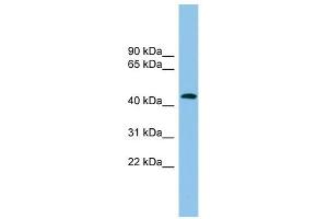 ACTR1B antibody used at 1 ug/ml to detect target protein. (ACTR1B antibody)